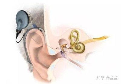 成人耳包的教程视频,轻松掌握成人耳包制作技巧